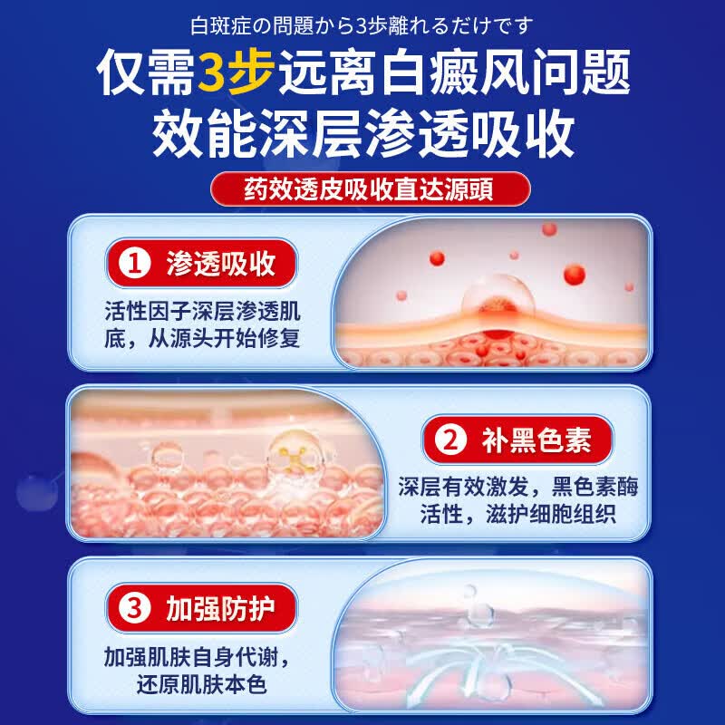 岩井昃弘日本进口白癜风药膏专用促进黑色素生长修复治白斑皮肤病遮盖液 特效买5送4【500%彻底冶裉】神奇 贝兰洁保健膏复方补骨脂酊医外用