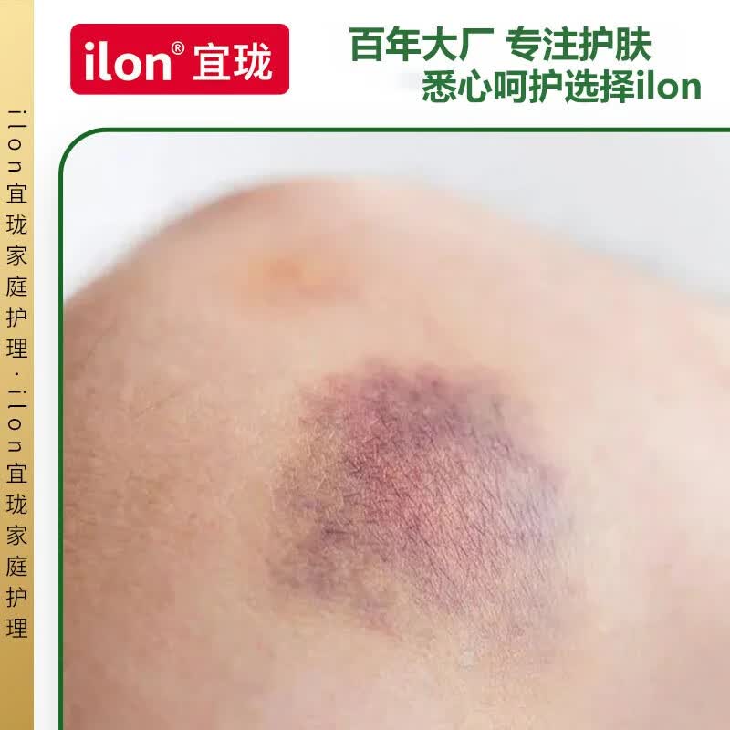 宜珑(ilon)德国礼达 Protect Salbe草本植物身体运动护理霜小绿管赛肤润同款 ilon护肤霜 50ml 1支 (浅绿膏体)