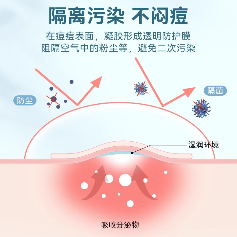 同仁堂痘痘贴消炎吸脓医用无菌敷贴祛痘贴防感染痘坑痘印消除水胶体敷料 1盒【消炎吸浓】36贴
