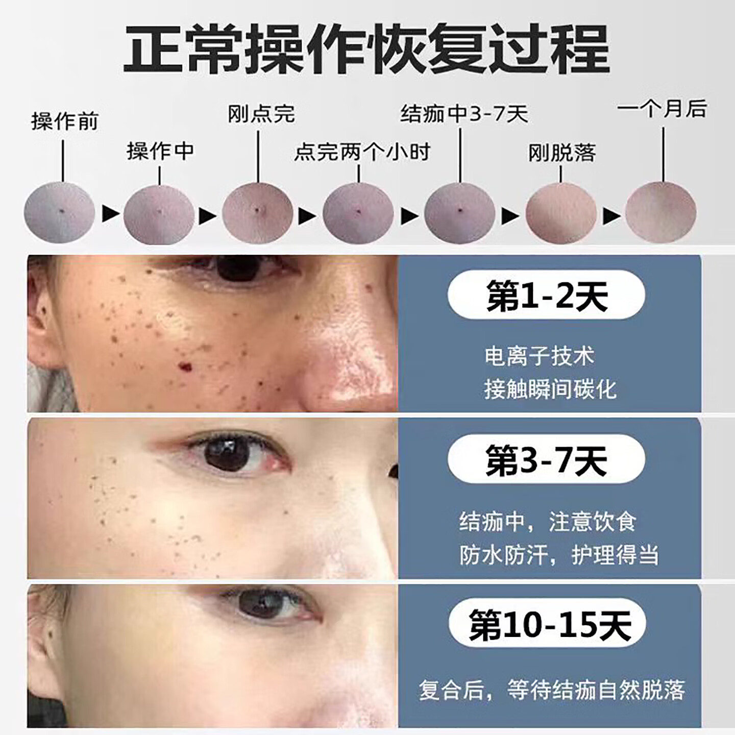 DIKTT【德国】扫斑去斑点痣笔2025新款小白激光祛斑美容院用点痔去痣点斑笔美容仪器女士女生节日礼物 玫瑰金【旗舰款-带防伪】9档蓝光修复+15重豪礼 旗舰