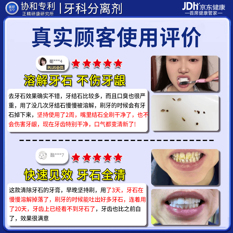 北京协和医学院牙结石专用牙膏溶解牙石去口臭去黄牙结石强力溶解液医用去除器 【永不再长牙结石】买五送四 牙结石清理神器溶解液速效漱口水