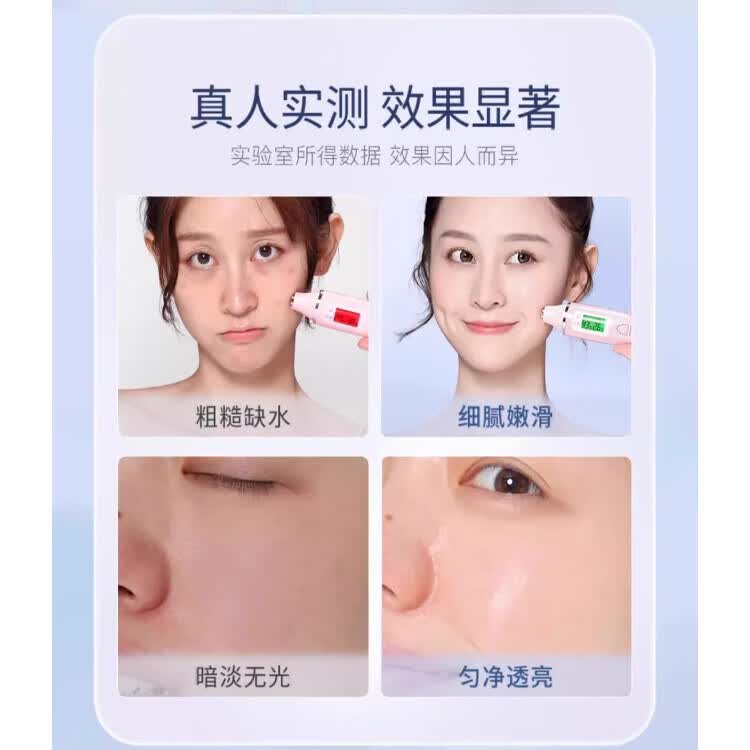 贝因维丝秘神博士面膜二裂酵母精华改善肌肤泛红修复红血丝 【五盒巩固装】买3送2 官方直售