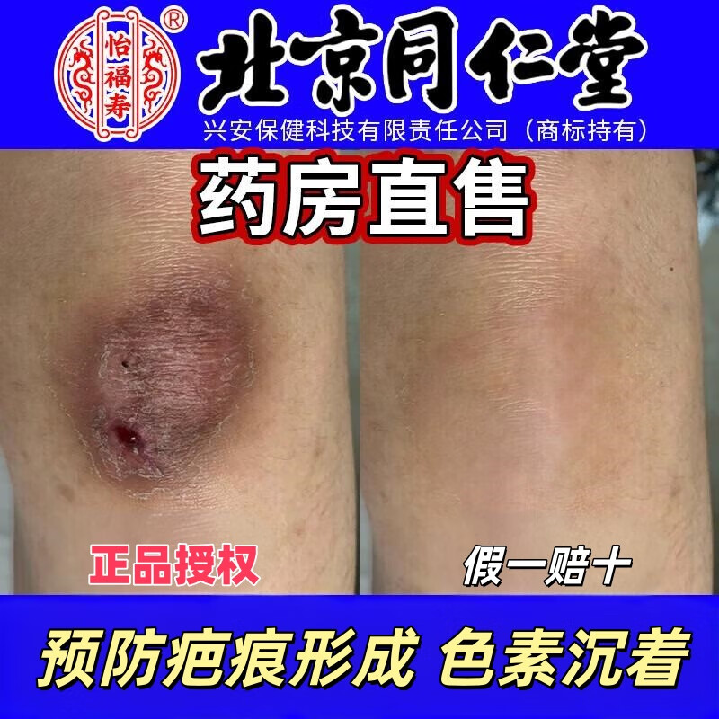 怡福寿北京同仁堂祛疤膏痘印黑色素疤痕印膏淡化疤黑印色素沉淀修复膏 三盒周期装（预防疤痕形成及色素沉着）