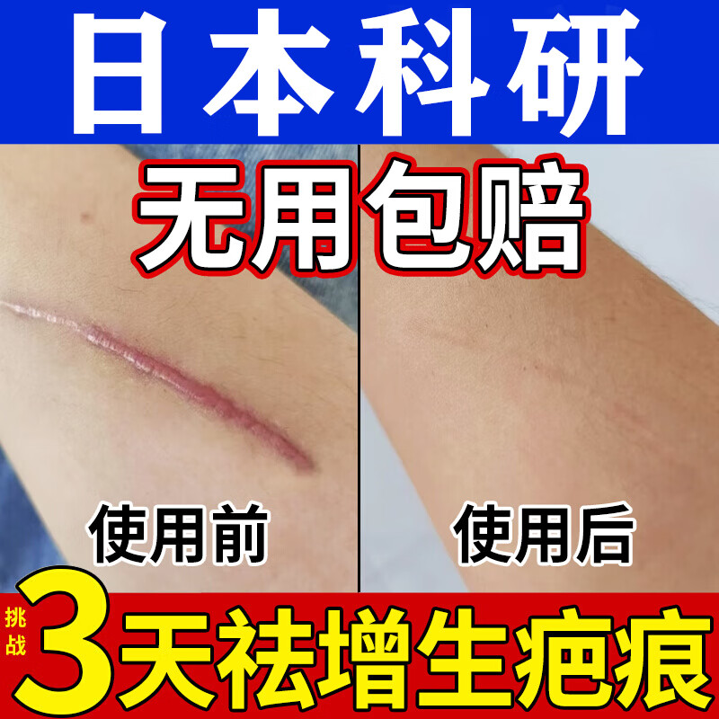 利奕菲去除疤痕修复凝胶医院专用祛疤膏手术缝针新旧疤痕增生凸起痒刀疤 【1盒装】适用于点痣痘印疤痕 疙瘩医用祛疤药膏灵医用硅酮疤痕凝胶儿童面部剖腹产