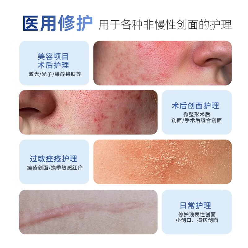 吉薇霓Givinie医用重组三型人源化胶原蛋白敷料修复软膏面霜水乳精华液 【医美术后修复】械字号胶原蛋白修护膏80g