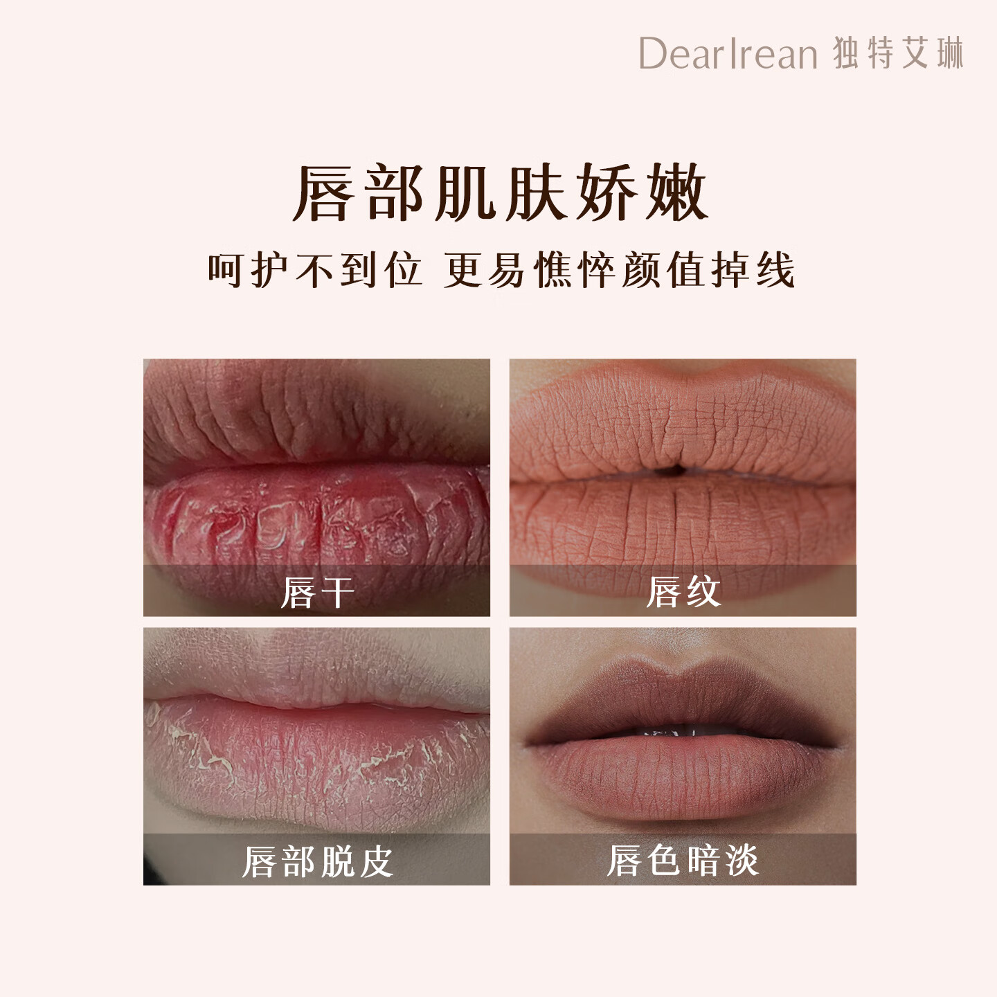 独特艾琳（Dear lrean） 柔润护唇膏保湿滋润男女润唇膏轻薄防干裂唇膜淡化唇纹去死皮 【橘雾呢喃】护唇精华油9.5ml