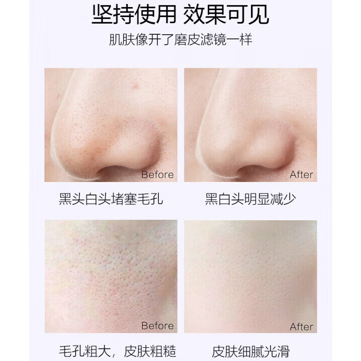 LUJAHA紫苏壬二酸去黑头清洁泥膜收缩毛孔正品黑头粉刺男女士补水面膜 【五盒巩固装】买3送2 官方直售