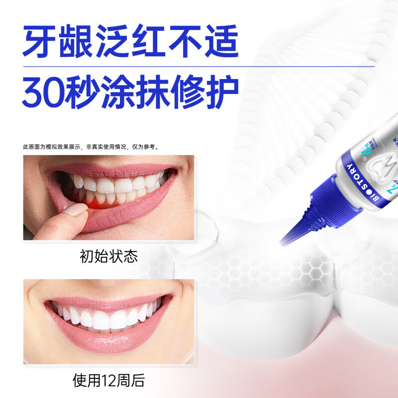 倍爱健牙龈精华牙膏牙结石牙菌斑蜂寡肽抑菌去口臭口腔护理成人护龈牙膏 牙龈精华牙膏*7支(含1支牙龈精华免费试用)