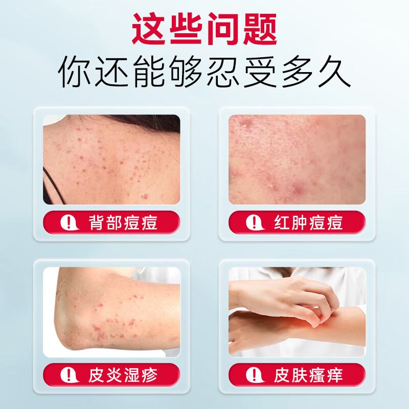 长白山医用皮肤喷剂敷料湿疹痤疮止痒外用顽固皮炎喷雾荨麻汗泡疱皮炎 5盒【疗程装】中重度面积大