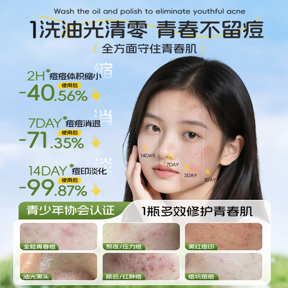 LILIA青少年氨基酸洁面乳12-18岁控油清痘洗面奶初高中生洁面深层清洁 300ml 【青少年必入】ko青春痘痘印黑头