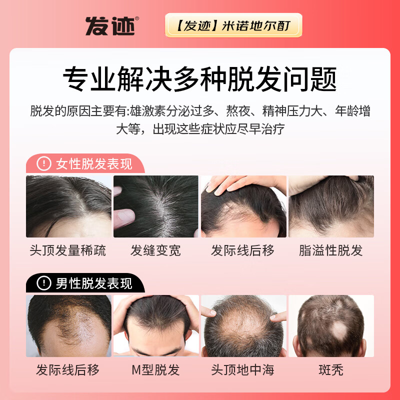 发迹 米诺地尔酊生发喷雾5%浓度28ml 男女性防脱发生发育发液 脱发严重专用 快速生发 增长发际线 【女士单瓶装】28ml*1瓶