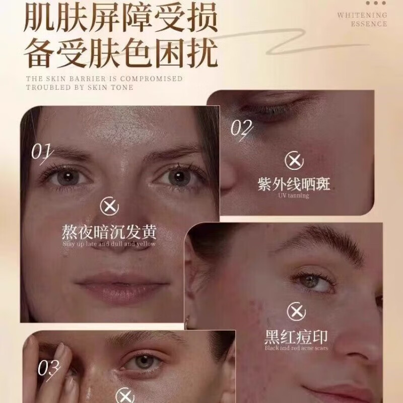 贝因维丝卡唯朵美白祛斑霜杨姐养肤草本堂直播同款淡斑老年斑阳阳官方正品 三盒加强版霜疗程装【中度斑点】科学淡斑 官方直售