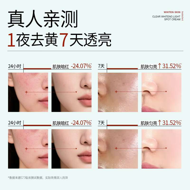 YERENTANG进口577美白祛斑霜淡化黑色素去雀斑黄褐晒斑补水保湿男女士专用 【美白升级】577美白祛斑霜50g