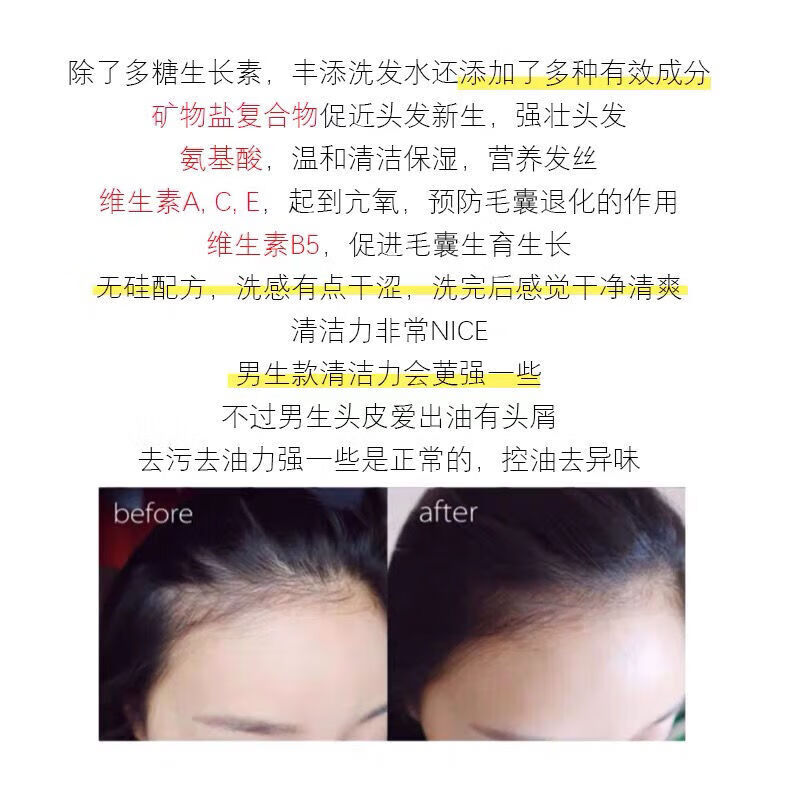 FOLTENE意大利丰添防拖洗头发水增发控油清爽男女士洗发 男用洗发水