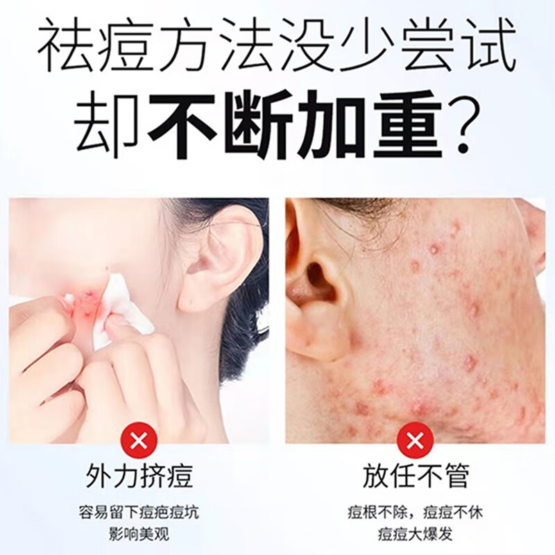 同仁堂痘痘贴消炎吸脓医用无菌敷贴祛痘贴防感染痘坑痘印消除水胶体敷料 1盒【消炎吸浓】36贴