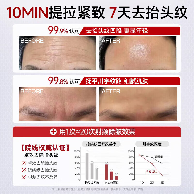 X.Y.B.S抬头纹去除神器重度额头纹皱纹提拉紧致抗皱男女专用烟酰胺凡士林 一盒体验装30G【一抹见效】