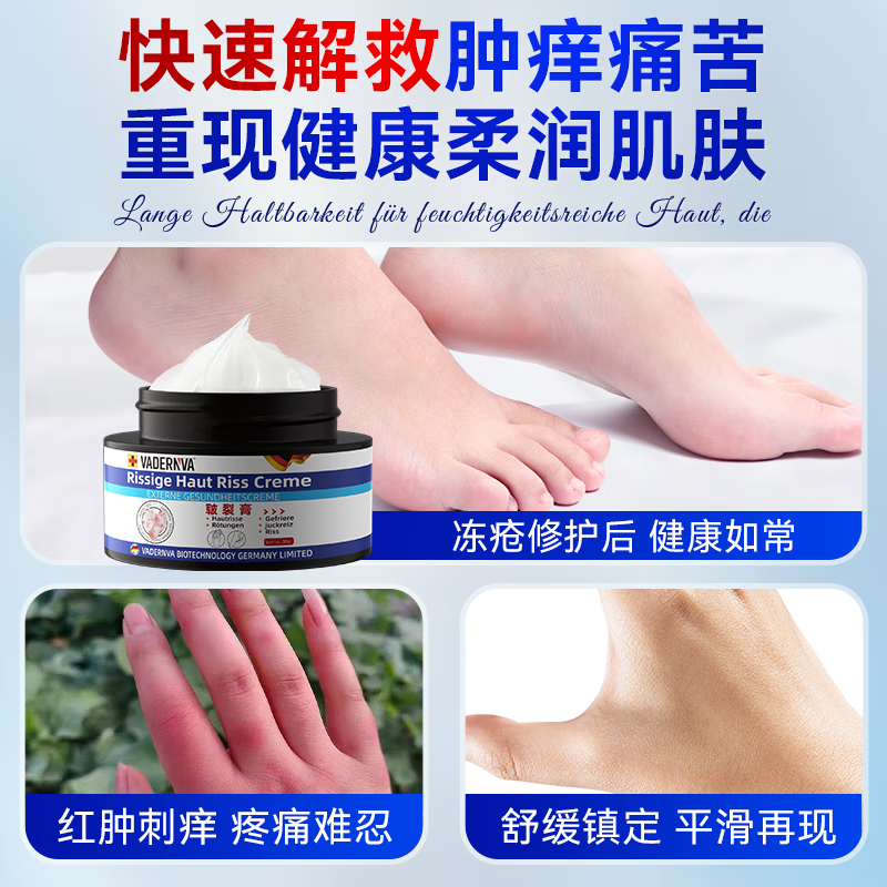 VADERNVA德国冻疮膏耳朵手足成人脸止痒冻伤膏消痛儿童男女士冻伤膏特效 三盒装【中重度】冻疮感染红肿出血