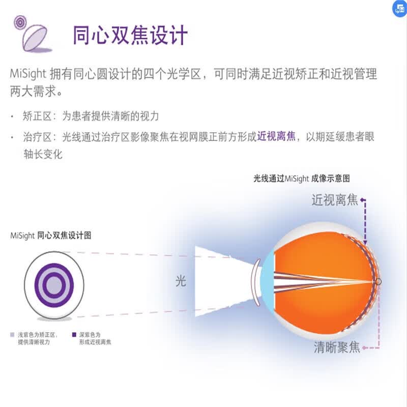 库博光学(CooperVision)MiSight离焦软镜儿童近视隐形眼镜进口软性接触镜日抛30片盒 150度