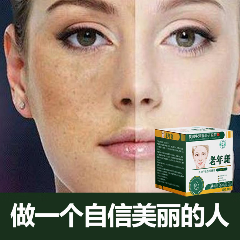 劲医扁鹊老年斑专用祛斑霜祛痘粉刺淡化黑色素雀斑黄褐斑晒斑正品 5瓶-祛斑霜祛斑黄褐斑雀斑晒斑女士用的