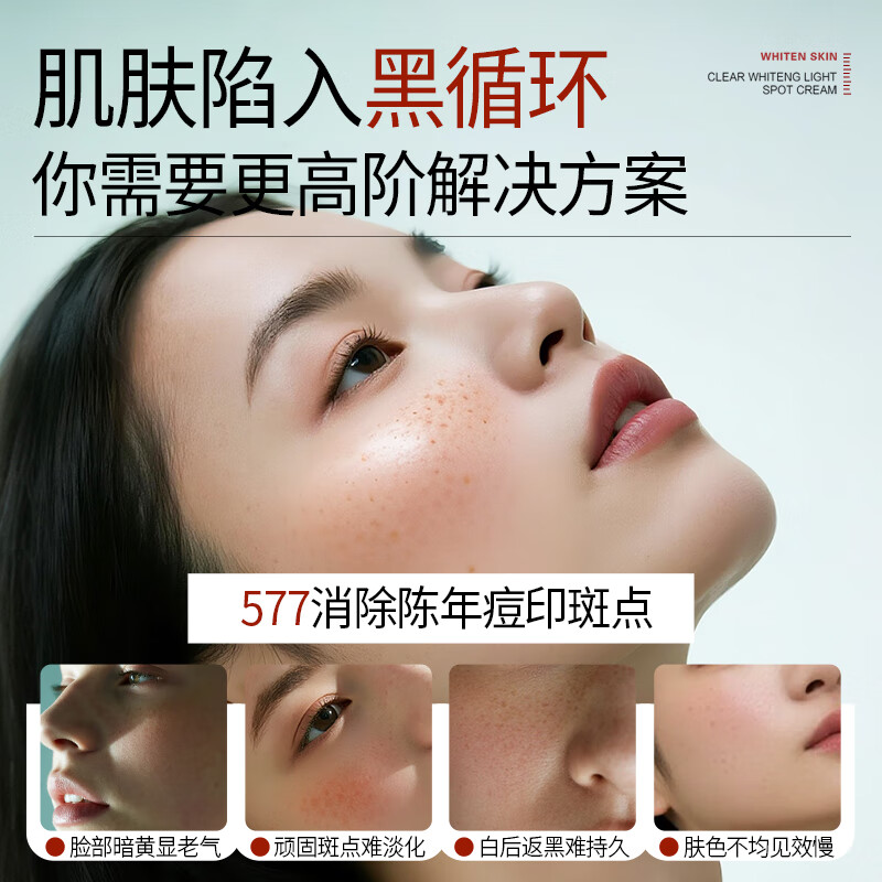 YERENTANG进口577美白祛斑霜淡化黑色素去雀斑黄褐晒斑补水保湿男女士专用 【美白升级】577美白祛斑霜50g