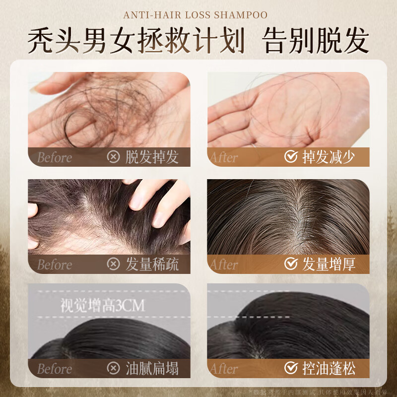 紫郁防脱固发洗发水洗发露生姜洗头膏固发去屑防掉断发控油 【科学防脱】防脱洗发水500g*2