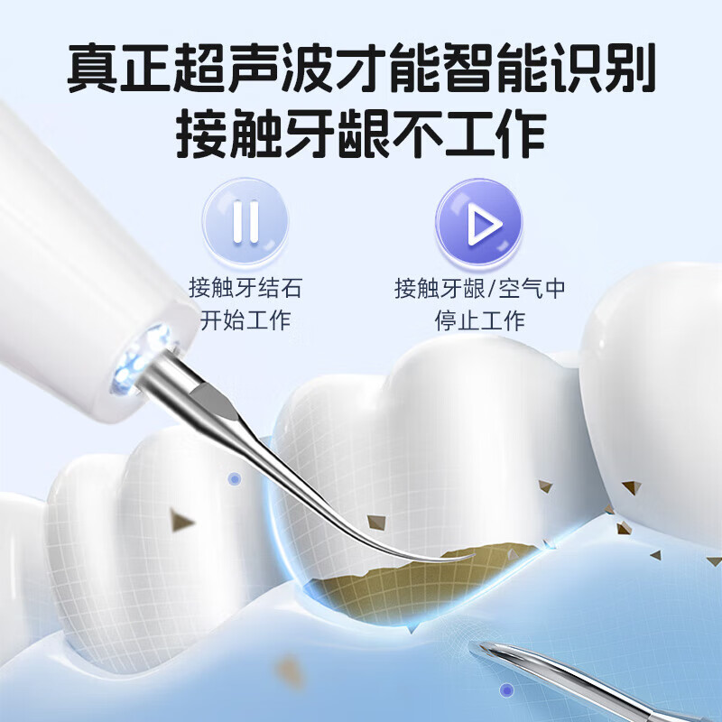 RASW德国牙结石去除器真超声波洁牙器洗牙仪可视化冲牙器礼物电动剔牙神器小家电清除牙垢工具烟渍清除 【可视白】五档+1500万像素+紫光杀菌 德国品牌 超清可视 精准清洁