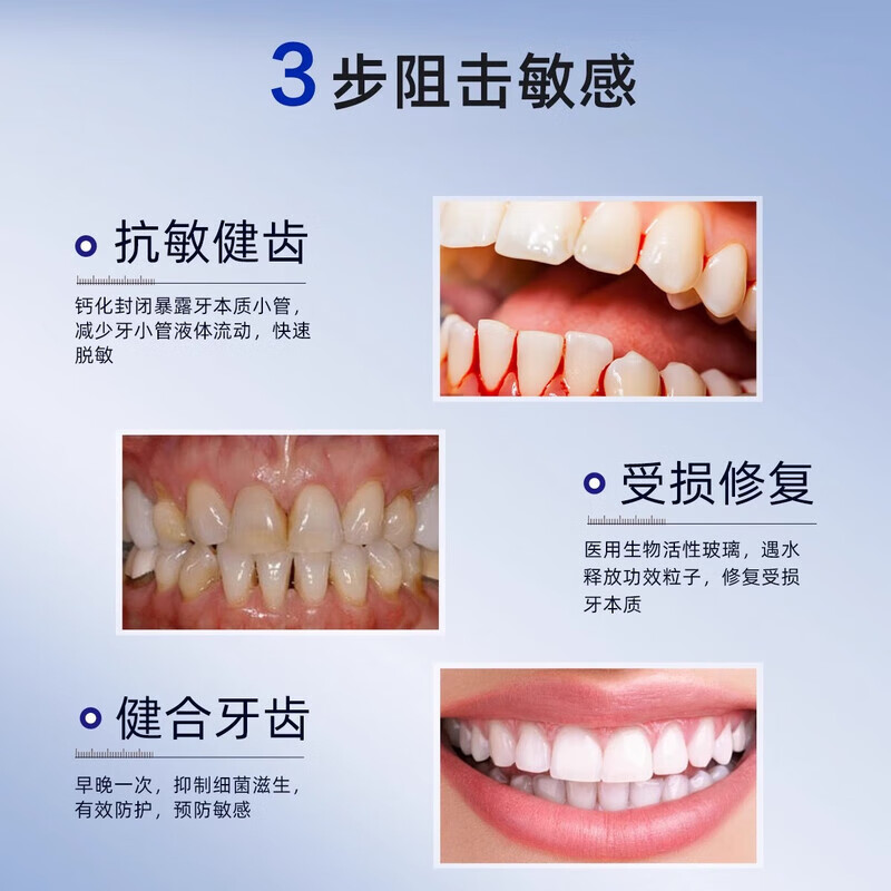 捷好特医用脱敏膏牙龈萎缩牙周炎专用牙龈出血去口臭去黄去牙结石去牙渍 【专治牙龈敏感】4支脱敏膏 （480g）