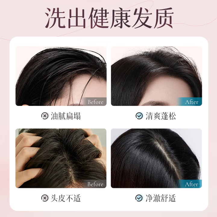 致朵舒缓去屑儿童洗发水温和清洁蓬松控油去屑止痒洗头膏女童 舒缓去屑洗发水/2瓶