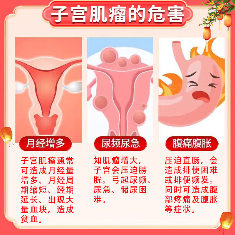 圣鑫堂子宫肌瘤专治药贴宫瘤消中药贴月经不调腺肌症消除子宫淤堵大肚子 买三送二【永绝后患】无效退 卵巢囊肿腺肌症宫颈息肉痛经贴