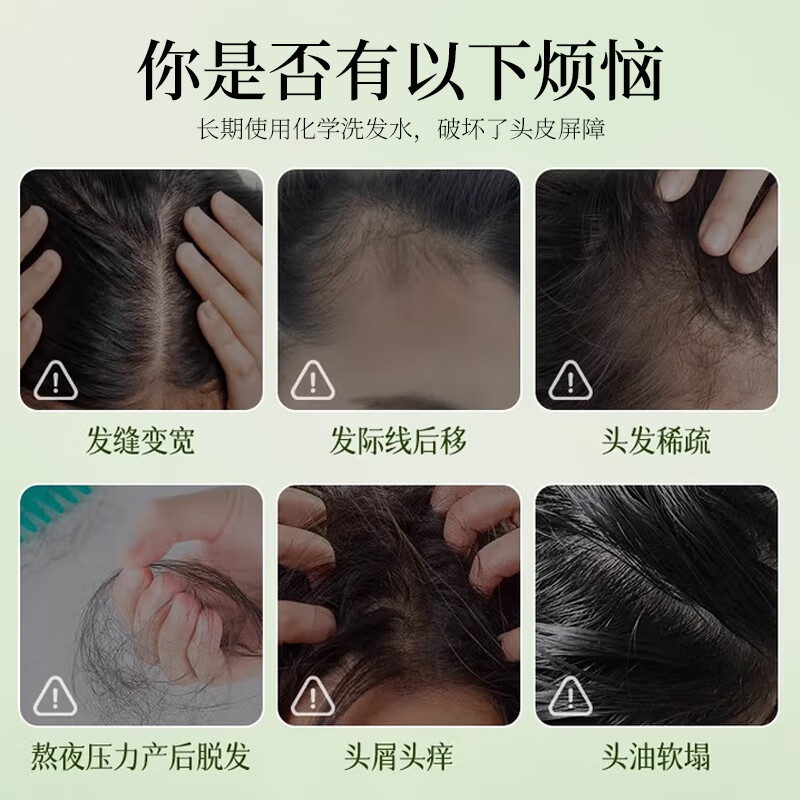 媛后侧柏叶洗牙膏清新口气牙龈护理减轻牙渍持久留香皂 侧柏叶洗发皂3盒