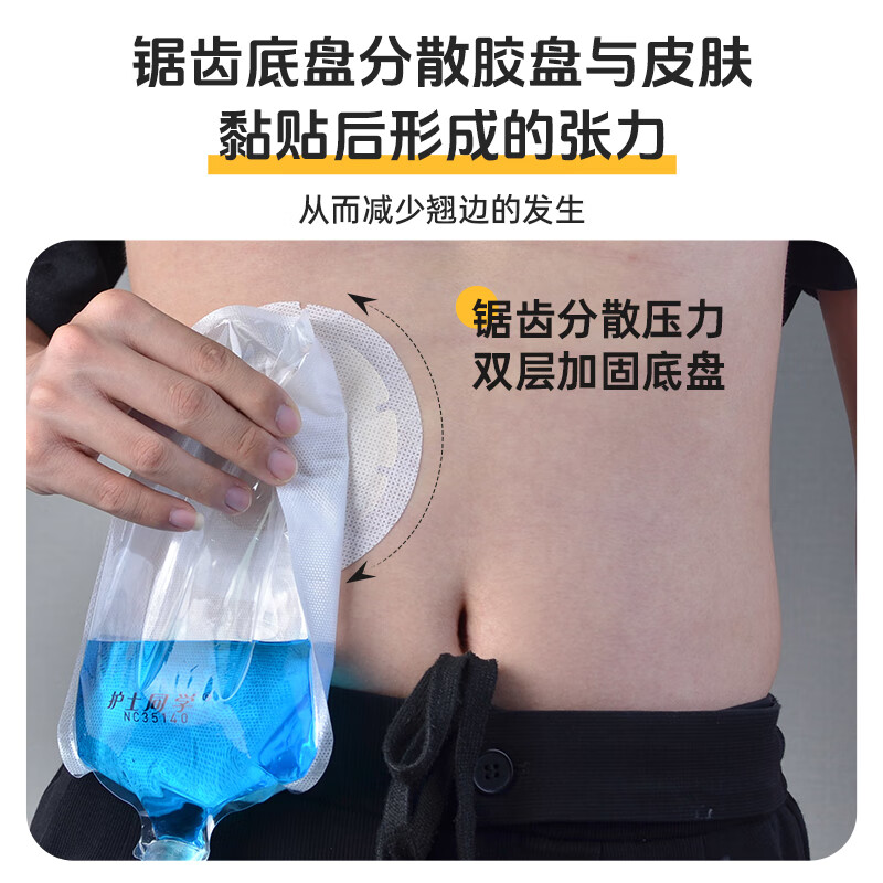 护士同学一件式泌尿造口袋小便引流袋膀胱全切医用一次性防逆流尿路造瘘袋 升级款双层锯齿底盘(10个装)