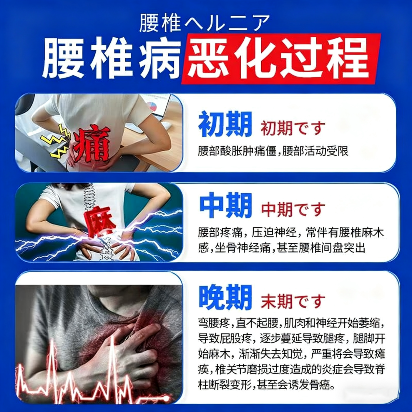 岩井昃弘腰椎间盘突出贴i膏压迫神经腰疼屁股疼腿疼腰肌劳损专用热敷贴 特效:1盒装【日本进口】 专研腰问盘 腰疼屁股疼腿专用
