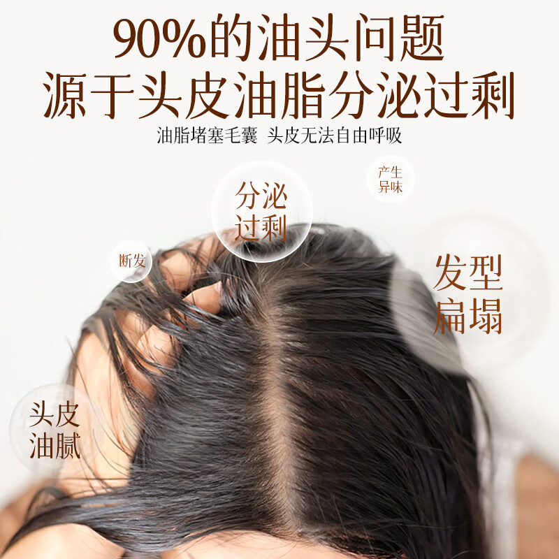 霸王生姜洗发水600g姜汁控油清爽柔顺滋养去屑洗头膏乳液留香男女 【控油清爽】生姜洗发套装共1232ml