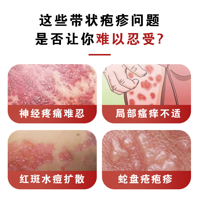健霖蛇胆灵 带状疱疹专用 医用级皮肤修复 蛇缠腰神经痛护理 买二送一(每瓶划118元)