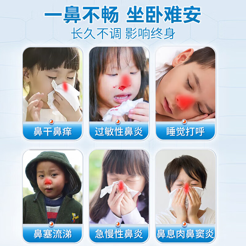 修正远红外鼻敏贴鼻炎鼻贴过敏性鼻炎鼻窦炎鼻甲肥大鼻塞通鼻膏药贴xl 超值1盒体验装【升级款】