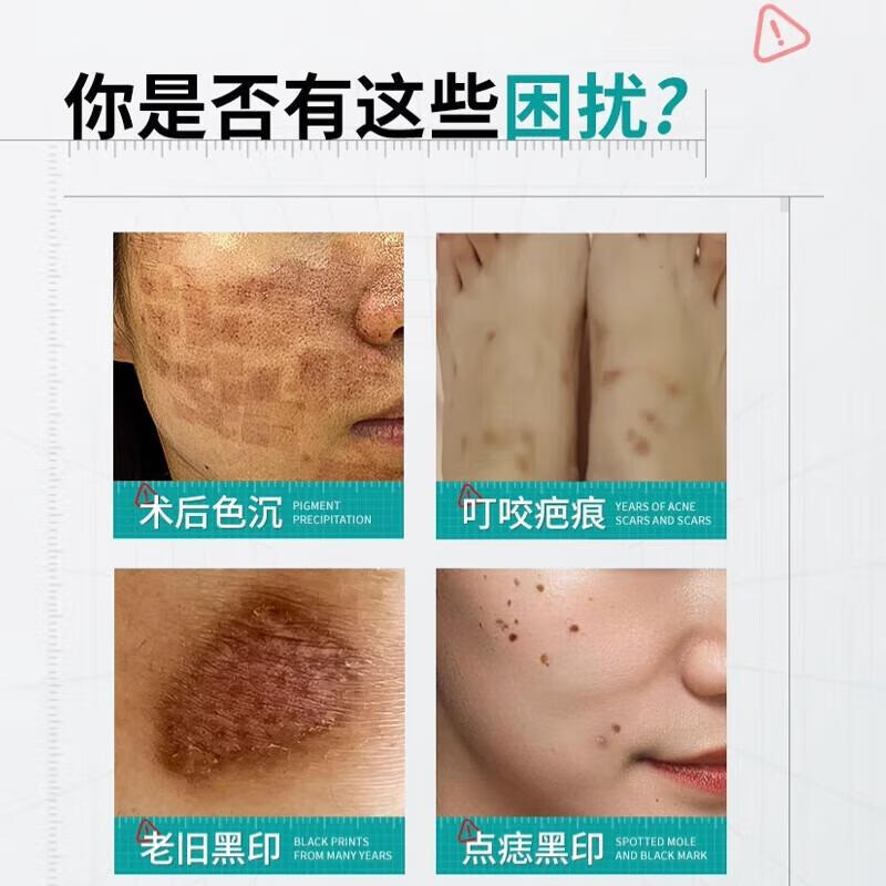 怡福寿北京同仁堂祛疤膏痘印黑色素疤痕印膏淡化疤黑印色素沉淀修复膏 三盒周期装（预防疤痕形成及色素沉着）