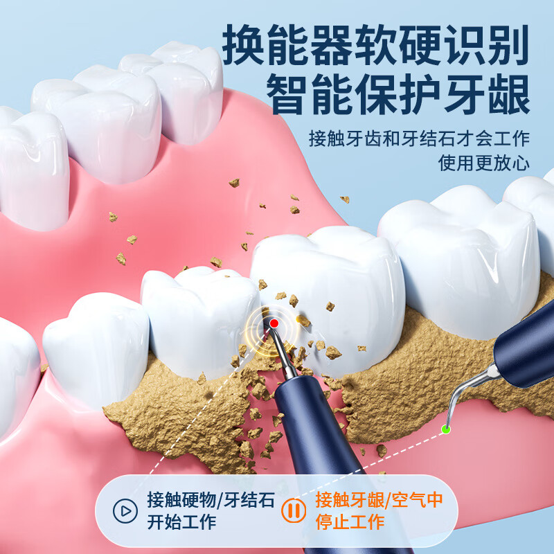 小米白色系列超声波洗牙器冲牙结石去除神器家用电动洁牙仪牙齿洁污垢除牙垢 蓝金色3000W高频超声波+轻松上手+洁牙碎石不伤 超声波
