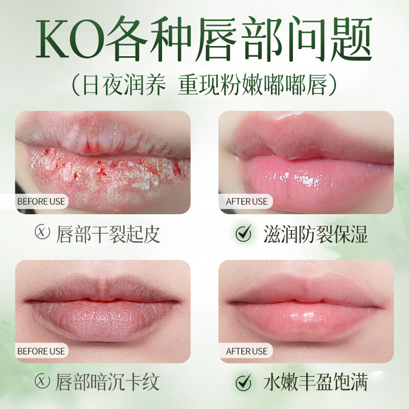 ehmznv凡士林润唇膏嘴唇死皮干裂脱皮保湿滋润无色淡化唇纹唇膜学生男女 凡士林润唇膏x3支