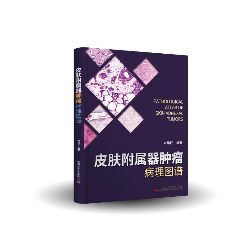 皮肤附属器肿瘤病理图谱(精)