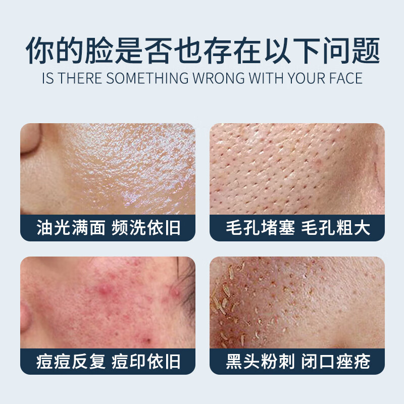片仔癀洗面奶女士深层清洁毛孔控油温和卸妆清爽男士国货除螨合一洁面乳 【旅行装5支共100g】除螨控油洁面