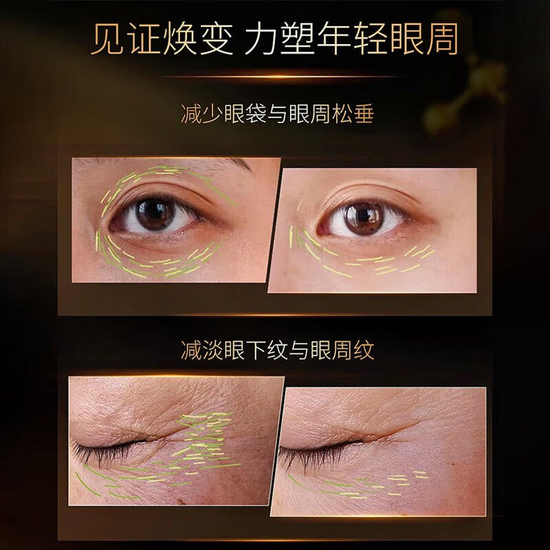 资生堂悠莱眼霜提拉紧致抗皱保湿淡化细纹中秋送女友老婆 【买一送一】电动眼霜20g+20g替换装