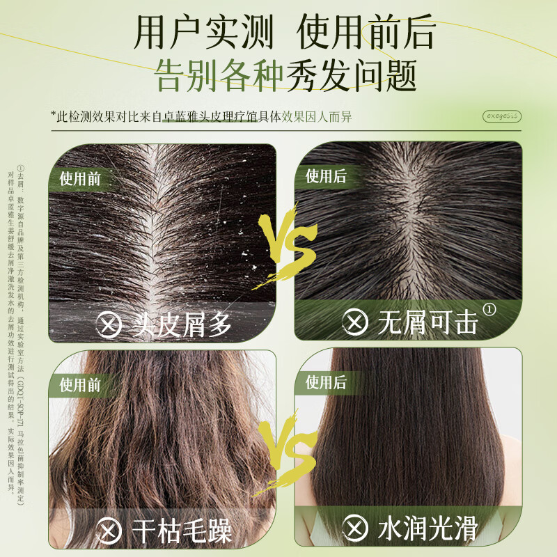 卓蓝雅(ZOOLY)生姜原液萃取去屑舒缓止痒净透清爽洗发水 去屑洗发水400mL	