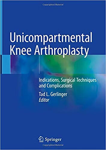 预订 unicompartmental knee arthroplasty