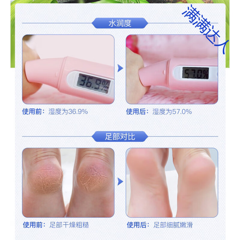 护手霜手干燥粗糙防干裂皲裂补水保湿滋润裂可宁皴裂膏 1瓶装