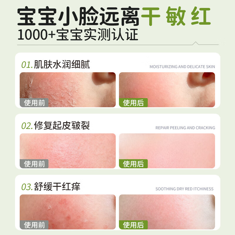 KoalaMan澳洲进口考拉侠金盏花儿童面霜婴幼儿宝宝霜滋润保湿舒缓修护补水 【全脸24H保护】面霜50g+唇膏15g