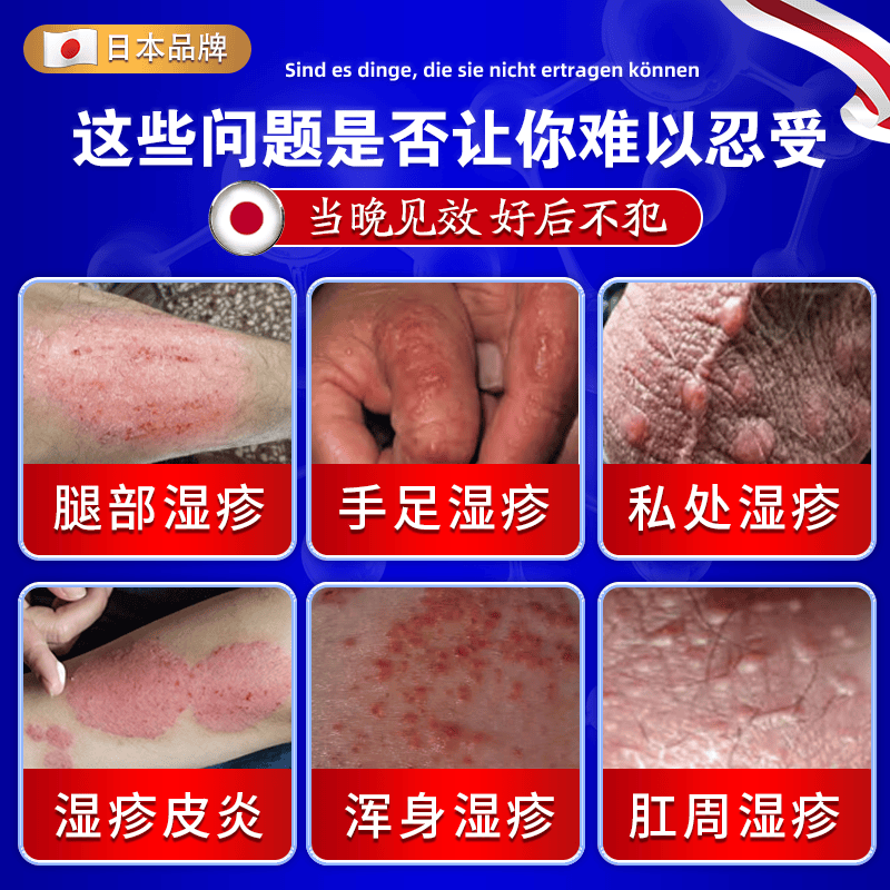北京协和医学院日本进口湿疹药膏湿毒清皮肤瘙痒皮炎100%真菌王感染去止痒根专用 特效1盒【日本原装进口】柏可芬软膏 苗药顽固湿疹热疹皮癣婴儿抑菌止痒膏湿疹药膏十大牌子