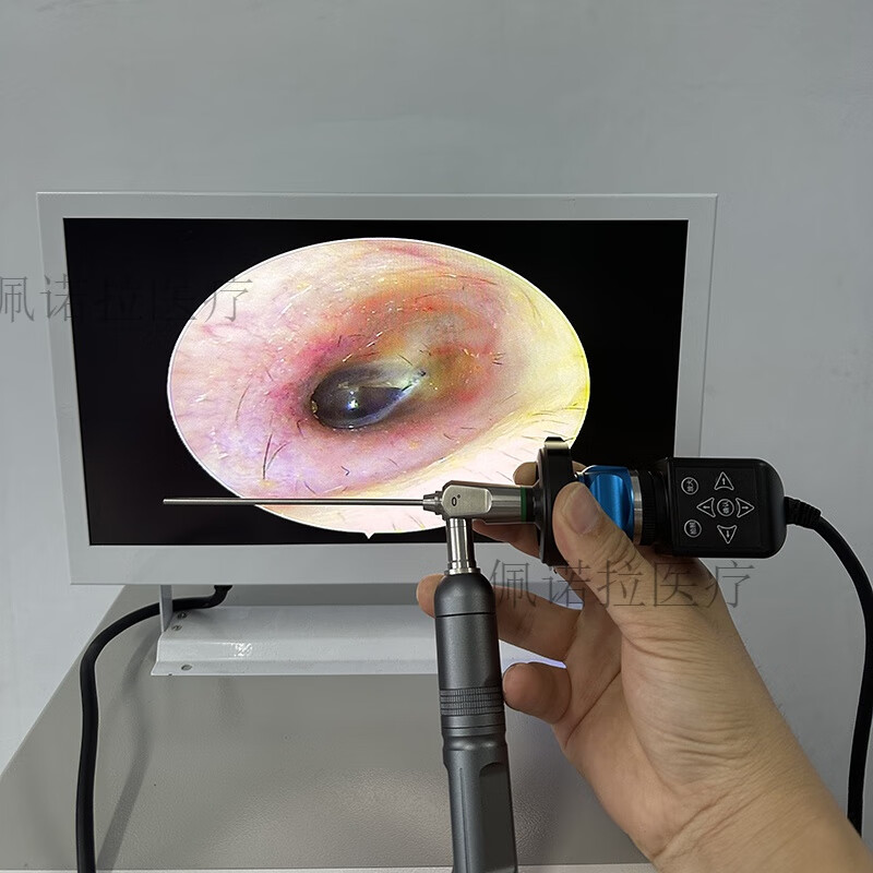 可视采耳仪器高清菜单键耳镜内窥镜拍照放大可调焦设备硬管冷光源 14