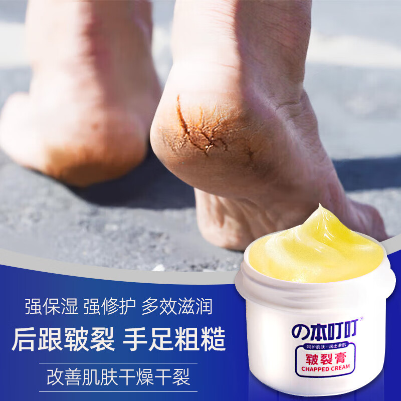 本叮叮保湿皲裂膏手足防干裂膏脚后跟干裂冻裂膏护足霜男女通用50g/瓶 【修护干裂】手足皲裂膏100g/2盒
