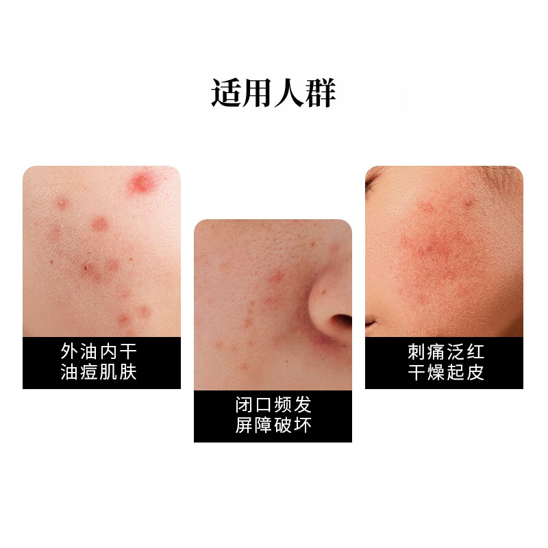 芳香世家小花茉莉精华油+薰衣草纯露护肤套装 面部护肤抗皱紧致淡纹焕亮 小花茉莉精华油10ml+薰衣草纯露100ml