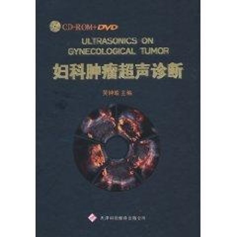 妇科肿瘤超声诊断（2DVD+2CD+书）